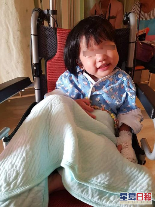 2歲女兒已經做過2次大手術。網圖