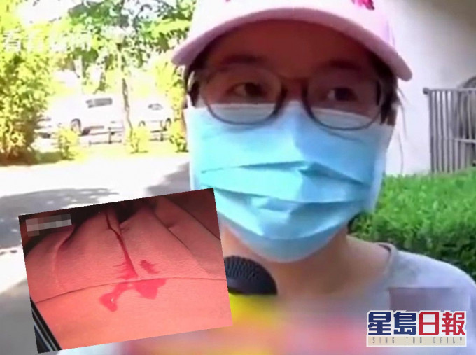 女子在小区楼下倒垃圾时,突然被从天而降的口水溅中。网图
