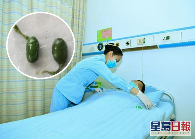 四川民眾周先生食用魚膽後中毒,需住院治理。網圖