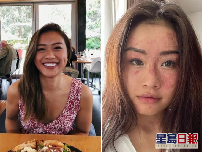 莎琳分享整個復原過程。IG圖片