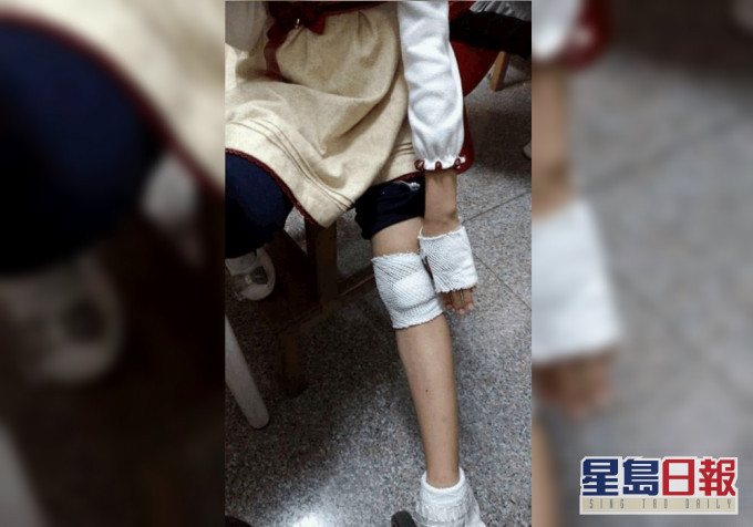 女童被车门弹到车底,险被公车辗过受伤。网上图片