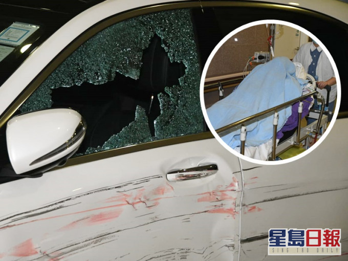男子遇伏擊心口中槍,警列企圖謀殺。