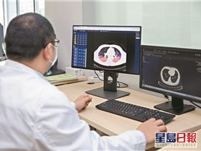 广东团队已研发出AI辅助诊断系统,20秒内即可识别患者是否感染新冠肺炎,诊断准确率达90%以上。(资料图片)