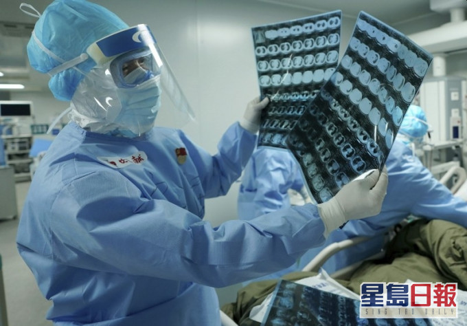 中国团队临床试验,发现抗爱滋病药物未能显著改善病情。AP