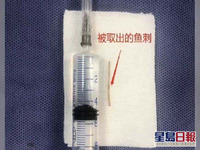 取出的魚骨。網圖