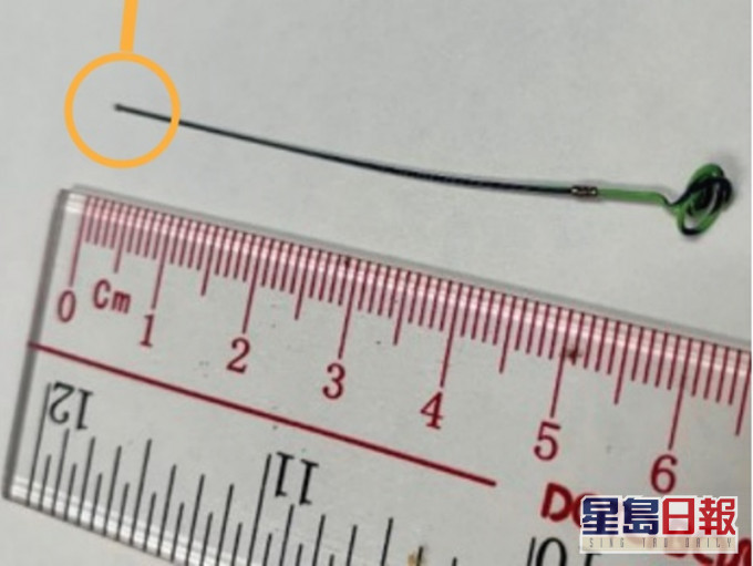 約6厘米的取石器碎片留在病人體內。《風險通報》季刊圖片