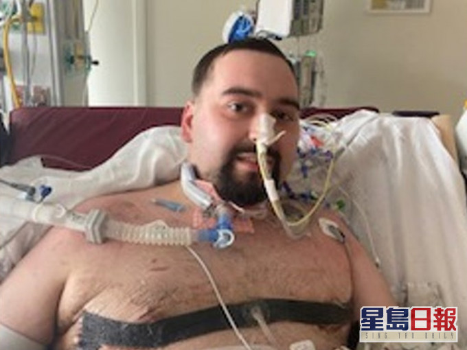 美国24岁男子Blaze拒打新冠疫苗后却不幸染疫,须接受双肺移植手术以保命。网图