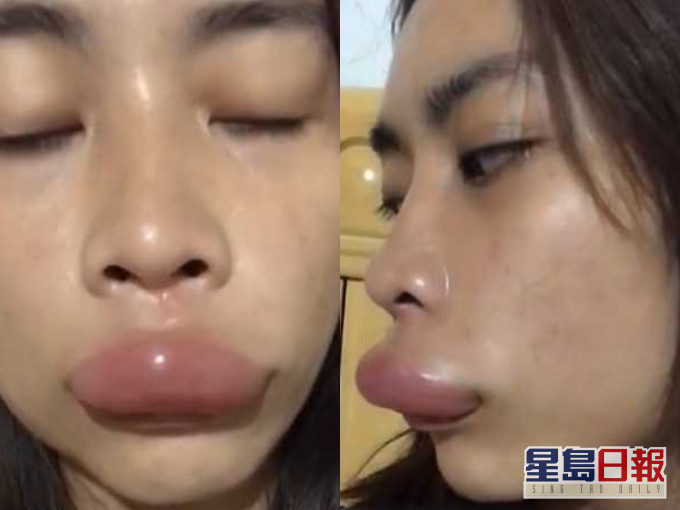 女直播變成了「孖膶腸」。網圖