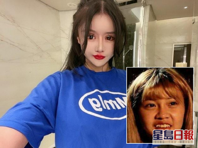 13岁起整容近百次致记忆衰退,上海网红周楚娜仍继续不断整容。