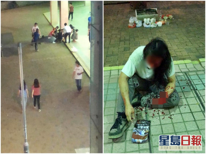 圖左為事發現場;圖右為其中一名傷者。「羅庭德 Jasper Law」fb圖片
