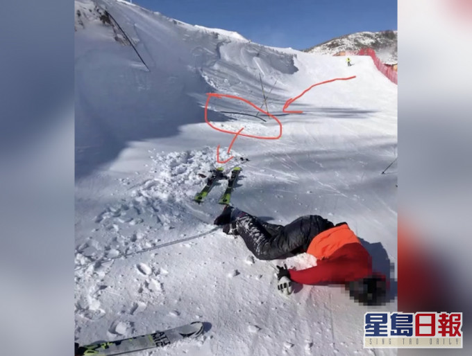 河北滑雪場遊客疑遭電纜絆倒摔亡。(網圖)