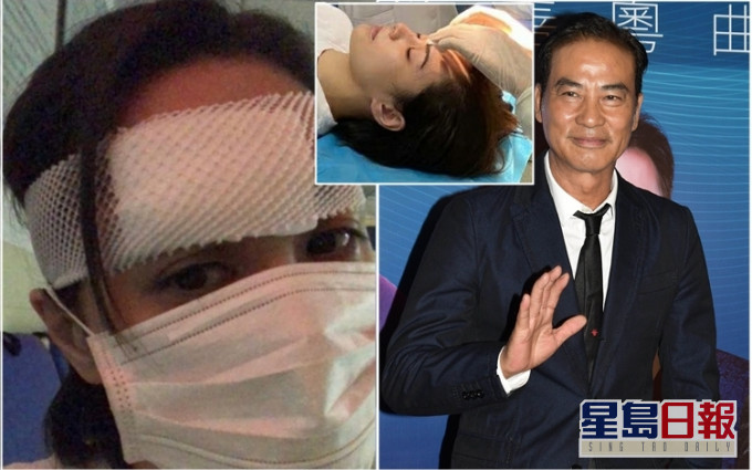 任達華介紹整形外科醫生給阿嬌接受治療,昨晚鍾欣潼已進行了第二次手術,傷口見骨。