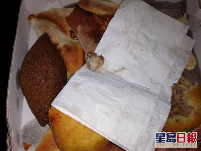 人類手指現肉餅。網圖