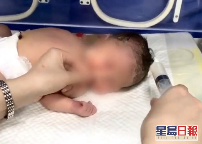 孙女蔡蔡要入院洗胃。网图