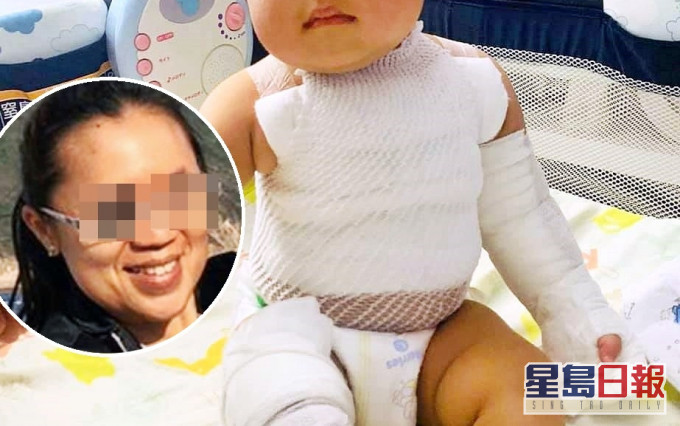 外傭(小圖)因熱湯放太近致小孩二級燒傷。 外傭僱主必看新聞訊息 公開群 FB圖片