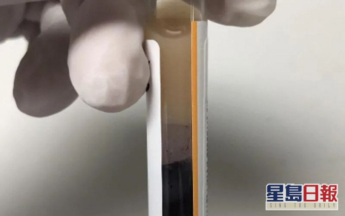 血液上層懸浮著油脂類物質乳糜血。網圖