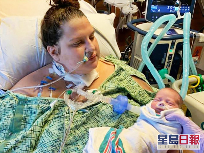 美國一名30歲確診孕婦早前病危住院,一度陷入昏迷20天,怎料再次醒來時發現孩子已出生。網圖