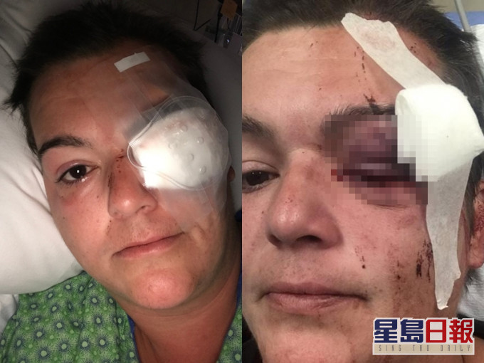 女自由攝影記者蒂拉多(Linda Tirado)來自納什維爾。網圖