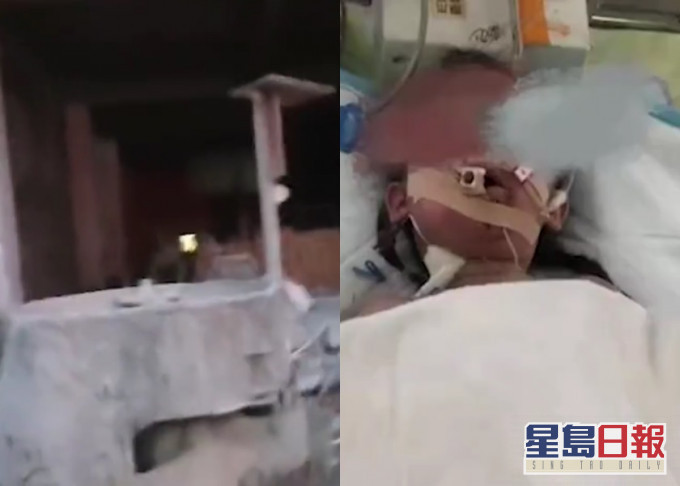 湖南发生工地事故，女童堕进水泥搅拌机受重伤。网上影片截图