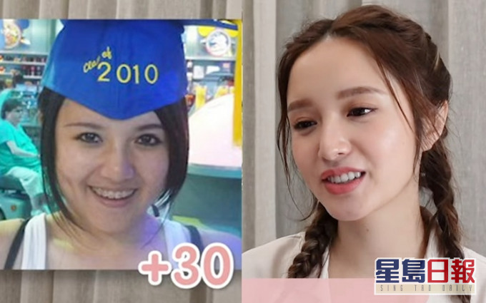 Judy公开17岁时的箍牙相,还比现在重30磅有多。