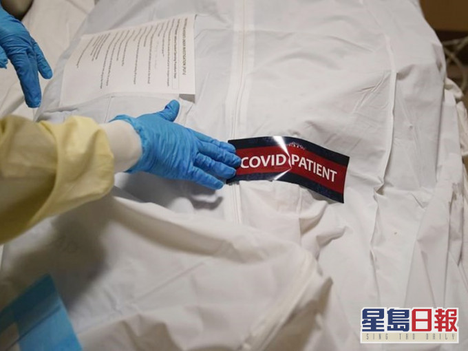 密歇根州一名婦女接受肺部移植手術後,感染新冠病毒死亡。AP資料圖片