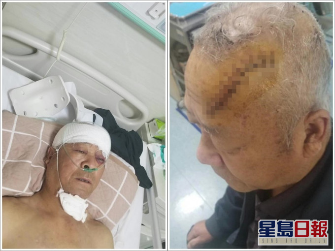 老翁入院縫了11針。網圖