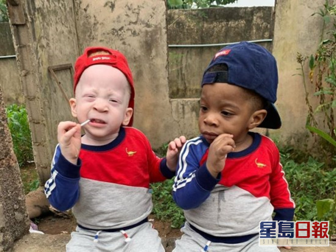 David(左)和Daniel(右)是一對黑白雙胞胎。網圖