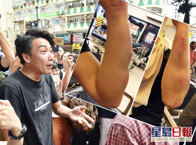 岑子杰去年8月底與友人在餐廳用膳時遭人伏擊。資料圖片