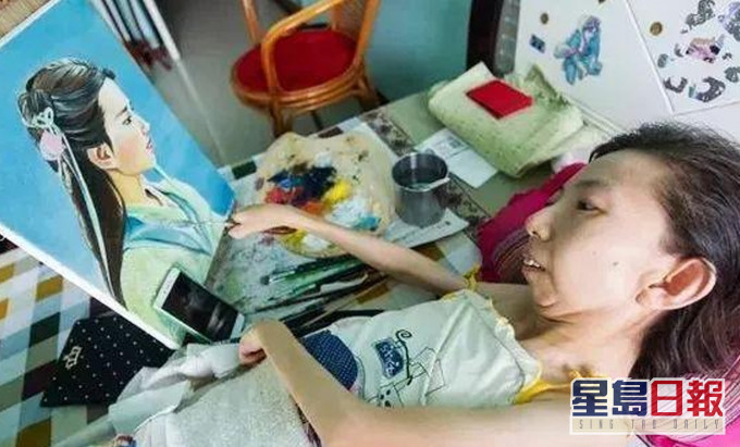来自山西的张俊莉在6岁不幸患病，8岁开始行动不便，整整卧牀37年。网图