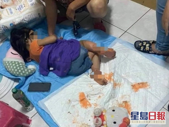 女童雙腳潰爛。網圖