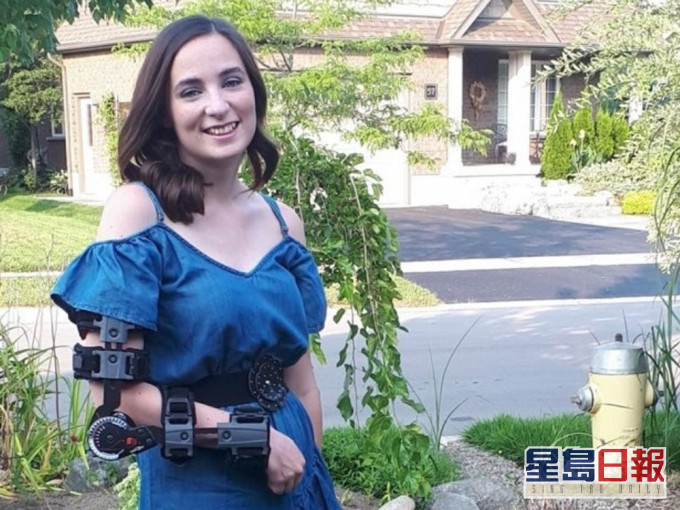 加國17歲少女捐血疑遭抽錯動脈,右手多年不能運作。