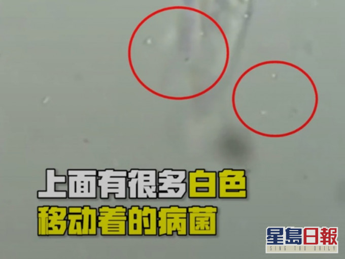 顯微鏡放大2000倍的口罩,可看到有細菌在移動。網圖