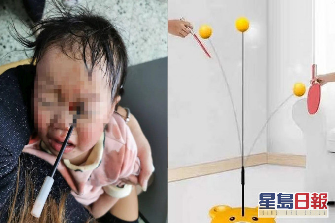 內地一款暢銷玩具存安全隱患,多名小童被弄傷眼睛,甚至腦部。(網圖)