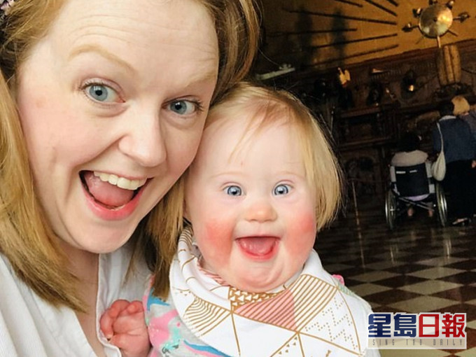 英國一名媽媽Helen,育有一名患唐氏綜合症的2歲女兒Eleanor Manton。網圖