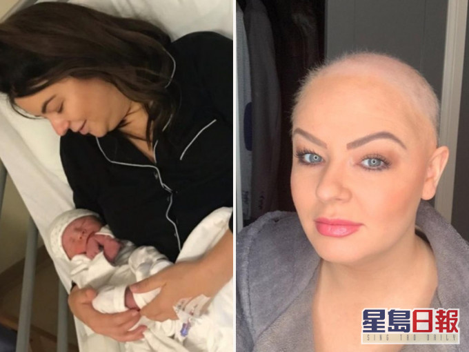 12次體外人工受孕均失敗,高齡媽甩光頭髮仍堅持受孕,6次流產後終成功產子。(網圖)