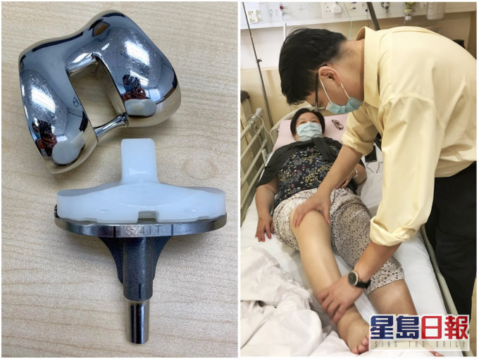 图左:人工关节。图右:张坚颖为病人作手术前检查。相片由宝血医院(明爱)提供