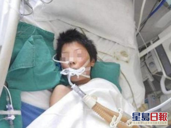 5岁男童遭爸爸虐打伤重不治,临终生日愿望是希望爸爸死掉。