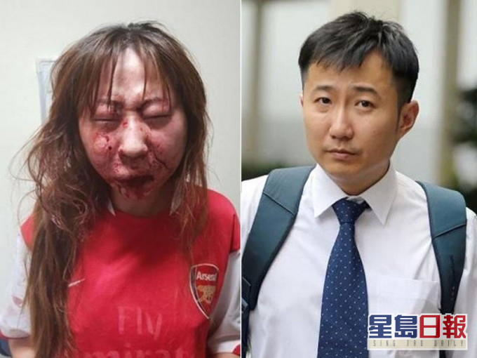 新加坡医生张顺杰（右），被林姓女友（左）指控酒后求欢遭拒后，将对方锁在房内暴打，张被判罪名成立。（网图）