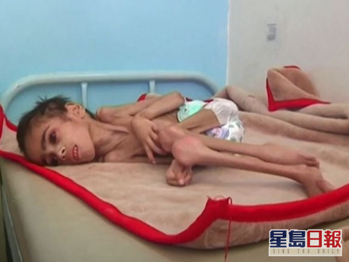 Faid 整個身體的骨架只佔醫院折疊好的毯子的四分之一。Al-Sabeen醫院推特