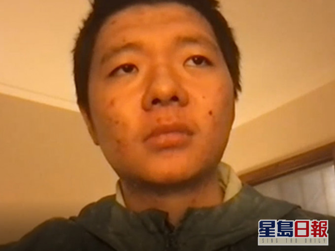王靖渝具有美國永久居民身分,現居歐洲。自由亞洲圖片