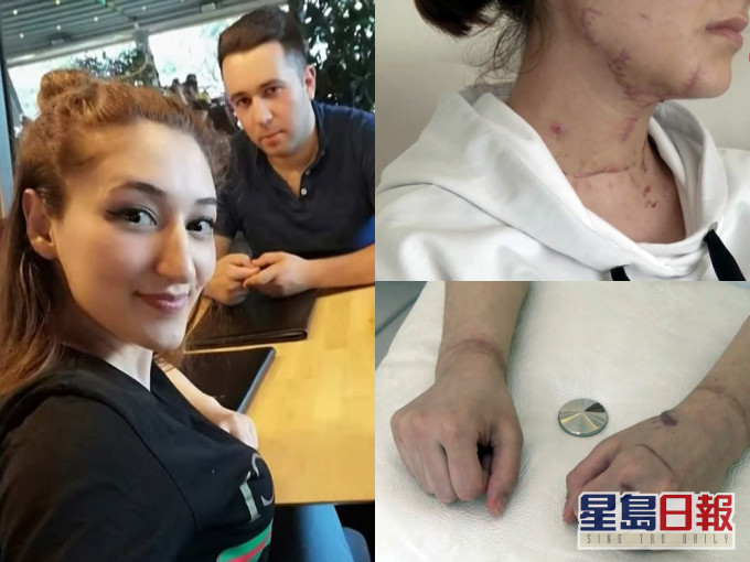 土耳其男子以送「驚喜」為借口,將女友綁手腳用刀狂刺兼開車輾過。