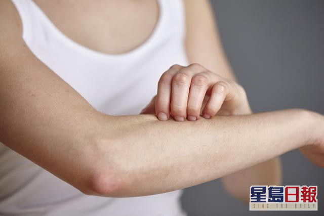 消委會指體味和二氧化碳或是吸蚊因素。網圖