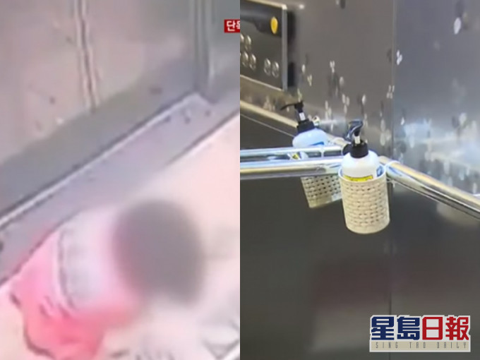 南韩五岁女用消毒搓手液意外射入眼睛。网上图片