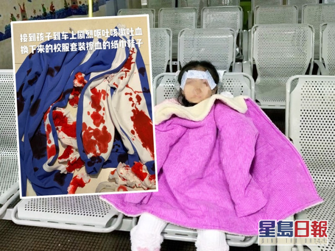 廣州老師疑涉嫌體罰致學生吐血,涉事教師已遭停職。網圖