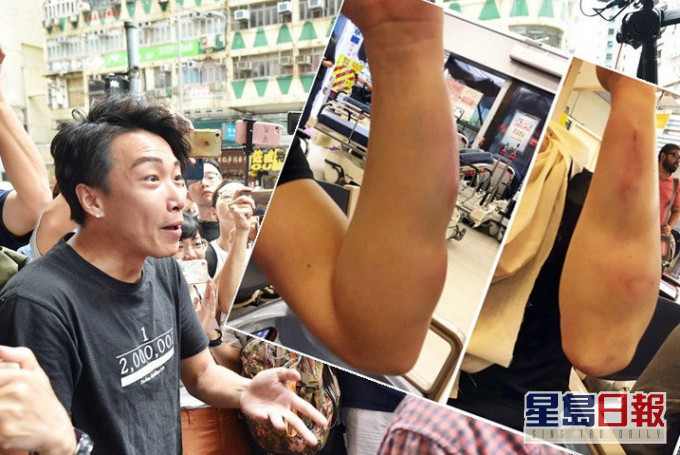 岑子杰偕友人去年8月底在佐敦用膳時遭伏擊。 資料圖片