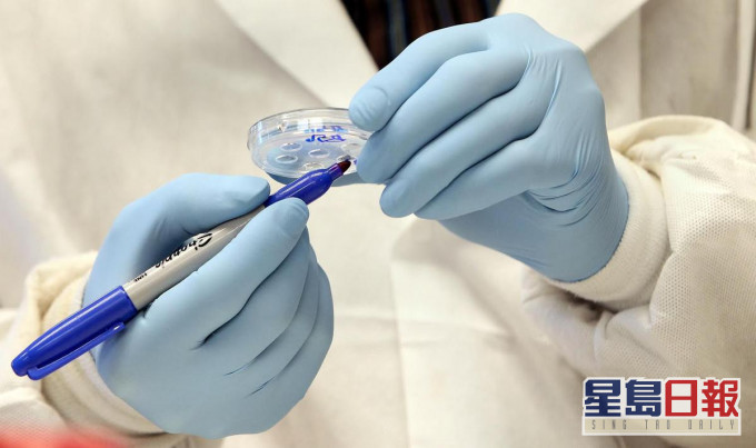 目前山谷热未有疫苗或特效药治疗。网图
