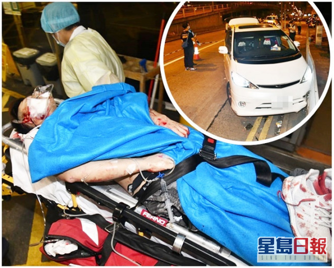 事主全身多處受傷,送往伊利沙伯醫院治理。小圖為涉案七人車。