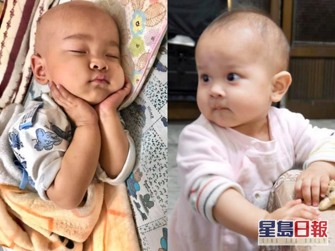 台歲半B女因肝腫瘤引發蜂窩性組織炎,經歷10次化療1次手術,終戰性病魔康復。(網圖)