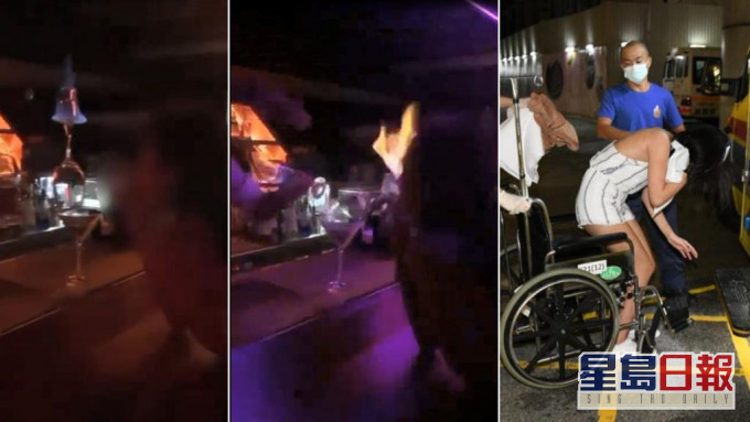 女子飲火焰林寶堅尼期間意外燒傷送院。