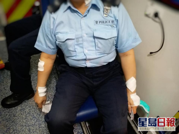 两名15岁少年涉高空掷腐液溅伤执勤警。警方图片